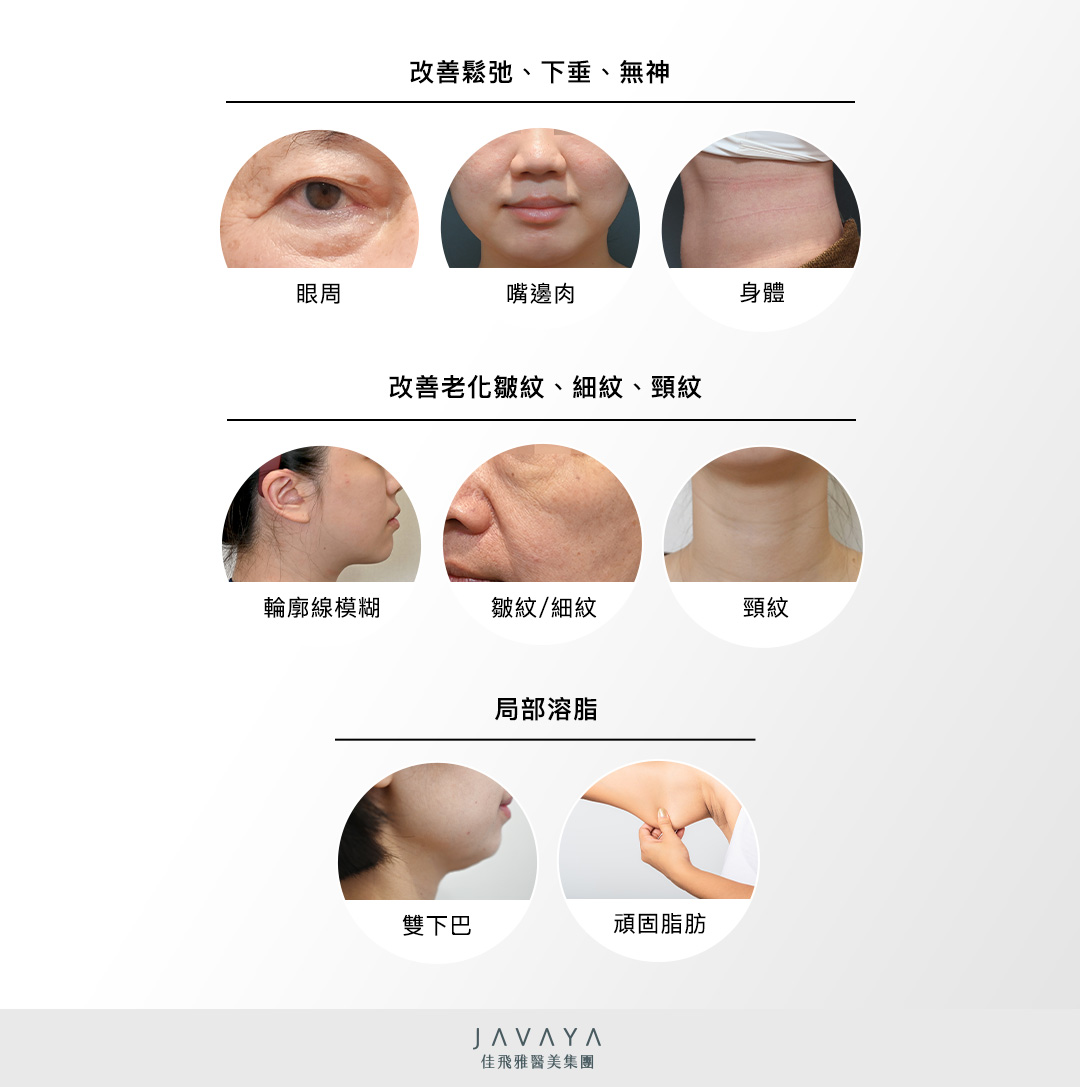 眉眼鬆弛下垂、無神、脂肪型雙下巴嘴邊肉明顯、下垂臉頰與頸部交界處輪廓線模糊、想改善臉部細紋或頸紋、身體大面積皮膚鬆弛、嘗試運動、節食，卻難以消除腹部腰圍脂肪、定期進行音波保養，但更追求高階治療體驗及效果全面者